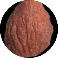 Ballsack